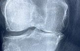 Supports & Braces