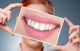 Teeth Whiteners